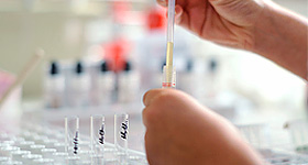 Labortest